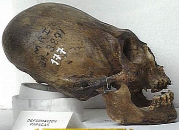 inca skull binding