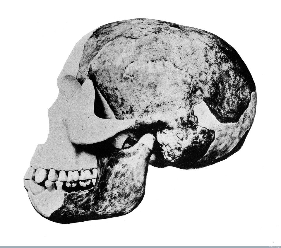 M0013579 Skull of the “Eoanthropus Dawsoni” (Piltdown Man)